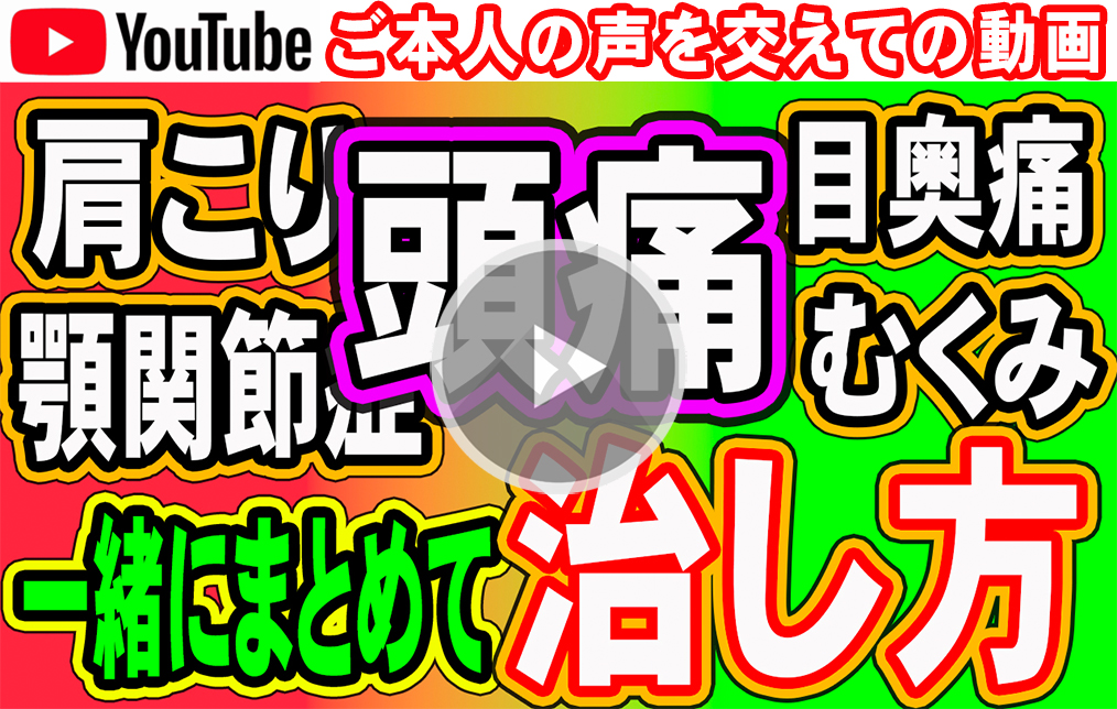 片頭痛