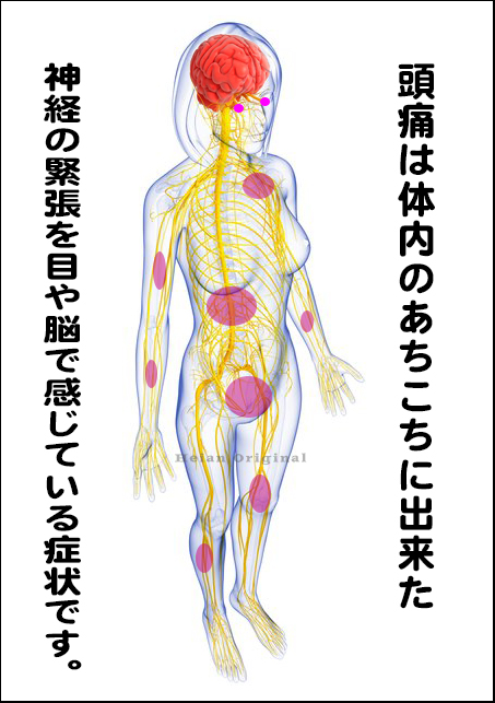 左側頭痛 , 頭痛専門整体院 平安コンディショニング 片頭痛 子供